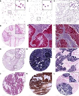 Presence of Human Papillomavirus and Epstein–Barr Virus, but Absence of Merkel Cell Polyomavirus, in Head and Neck Cancer of Non-Smokers and Non-Drinkers